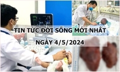 Tin tức đời sống ngày 4/5/2024: Cô gái mắc thủy đậu mức độ nặng, sốt tới 41 độ