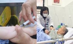 Người đã tiêm vaccine cúm có mắc cúm không?