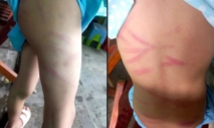 Vụ bé 6 tuổi bị mẹ ruột đánh đập dã man ở Hậu Giang: Hoàn cảnh gia đình rất khó khăn