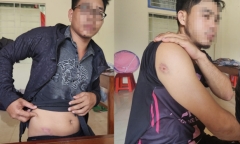 Quảng Trị: Đi gặt lúa thuê, ba người bị nhóm thanh niên hành hung
