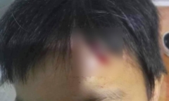 Lời kể của bé trai 10 tuổi nghi bị mẹ kế bạo hành ở Cà Mau