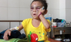 Cuộc sống mới của bé gái từng bị mẹ và cha dượng đánh đập dã man