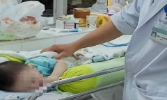 Tạo hình khí quản cho bệnh nhi 7 tháng tuổi nhập viện trong tình trạng nguy kịch