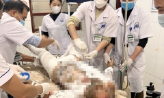 Nghi do mâu thuẫn với vợ, người chồng đổ xăng lên người tự thiêu