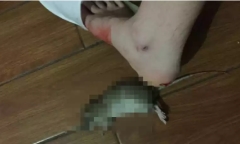 Bị chuột cắn, cô gái 18 tuổi có màn 