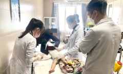 Hai bệnh nhi bị bỏng nặng do nước sôi, bác sĩ cảnh báo gì?