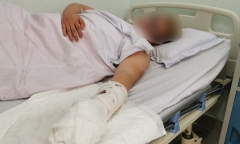 Tin tức pháp luật mới nhất ngày 5/2: Bị chém đứt lìa ngón tay khi đang đá bóng