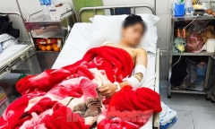 Vụ nam sinh Lào Cai bị 2 con chó gần 60kg cắn: Chủ nuôi bị phạt bao nhiêu tiền?