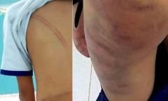 Tin tức pháp luật mới nhất ngày 8/3: Diễn biến mới vụ mẹ kế đánh con chồng ở Cà Mau