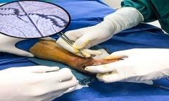 Bác sĩ Bệnh viện Nhi Trung ương chỉ cách sơ cứu khi con trẻ bị rắn độc cắn tại nhà
