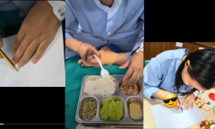 Tạo hình 2 ngón chân thành 2 ngón tay cho người phụ nữ bị tai nạn mất ngón