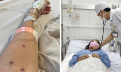 Người bệnh sốt xuất huyết bị cảm giác 