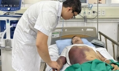 Người bệnh sốt xuất huyết tím đen toàn thân nguy kịch, bác sĩ tuyến trung ương nói gì?