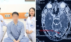 Nam thanh niên 27 tuổi đột quỵ sau tắm 10 phút, lời khuyên hữu ích từ bác sĩ