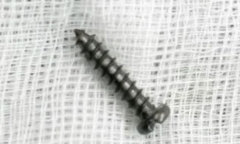 Gắp thành công đinh vít dài 2cm trong dạ dày bé gái 2 tuổi