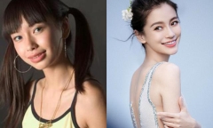 Sử dụng trái phép hình ảnh thời chưa chỉnh răng của Angela Baby, một bệnh viện nha khoa bị kiện