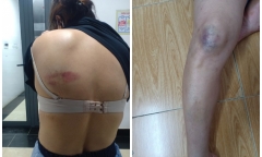 Mẹ và con trai bị đánh phải nhập viện, không nhận được một lời xin lỗi