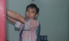 Khống chế nam thanh niên biểu hiện “ngáo đá” đâm trọng thương 3 người