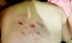 Vụ nữ giáo viên bị 
