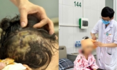 Hà Nội: Hai trường hợp bị tấn công bởi chó nhà nuôi