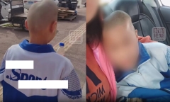 Bé trai bị biến dạng đầu và trầm cảm sau khi bị giáo viên đánh vì quên mang sách