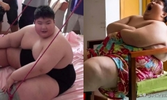 Cậu bé 14 tuổi nặng 180kg khóc xin bác sĩ giúp giảm cân giờ ra sao?