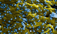 Virus Marburg khiến 2 người ở Ghana tử vong nguy hiểm ra sao?