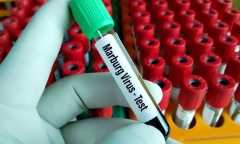 Loại virus khiến 9 người tử vong ở Guinea Xích đạo nguy hiểm ra sao?