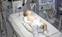 Bé gái 3 tháng tuổi bị người tình của mẹ bạo hành: Sức khỏe giờ ra sao? 
