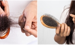 Nếu rụng tóc trên 100 sợi/ngày rất có thể bạn đang gặp vấn đề bất thường do bệnh lý
