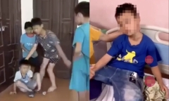 Vụ nam sinh lớp 7 bị đánh hội đồng dẫn đến nhập viện: Nạn nhân bị rối loạn phân ly
