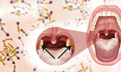 Thực hư thông tin TP.HCM xuất hiện ca bệnh bạch hầu