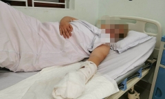 Hải Phòng: Nam thanh niên bị chém đứt lìa ngón tay khi đang đá bóng