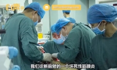 Tin tức đời sống ngày 21/9: Người đàn ông suýt phải cưa tay vì chủ quan với vết muỗi đốt