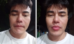 Lê Dương Bảo Lâm gây phẫn nộ khi thản nhiên nói tục ngay trên sóng livestream