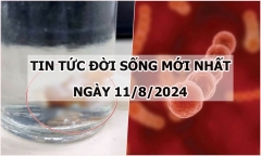 Tin tức đời sống ngày 11/8/2024: Răng giả kẹt trong phổi người đàn ông 56 tuổi