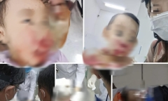 Công an Tiền Giang xác minh vụ người mẹ tố CSGT đánh trúng mặt con trai