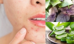 Mẹo làm sạch mụn bằng các loại lá có đầy ngoài tự nhiên cực hiệu quả 