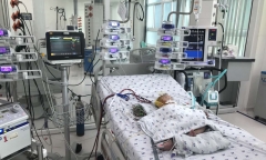 Tin tức đời sống ngày 11/12: Can thiệp ECMO cứu bé 7 tháng tuổi sốc sốt xuất huyết