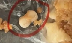 Trung Quốc: Đang ăn bánh bao, người dân vội vàng báo cảnh sát khi thấy vật lạ bên trong