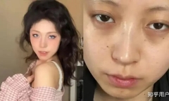 Ngoại hình xuống sắc sau 1 năm đi làm, cô gái được công ty bồi thường hơn 30 triệu đồng để làm đẹp