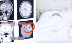 Cô gái mất khả năng nói tiếng Anh dù từng thông thạo, bác sĩ bối rối đi tìm nguyên nhân