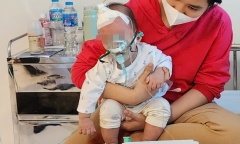 Hà Nội: Tổ chức khoanh vùng, xử lý triệt để khu vực có bệnh nhân, ổ dịch sởi