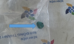 Tin tức đời sống ngày 21/2: Viên pháo phát nổ khiến bé 5 tuổi tổn thương bàn tay phải