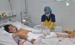 Nam sinh 11 tuổi bị thương nặng do chơi pháo