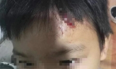 Chủ tịch tỉnh Cà Mau chỉ đạo làm rõ vụ bé trai 10 tuổi nghi bị mẹ kế bạo hành