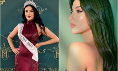 Á hậu kiêm người mẫu nổi tiếng Vera Safaryan qua đời ở tuổi 32 sau 9 ngày hôn mê 