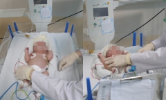 Mới đẻ được 45 ngày, trẻ sơ sinh mắc căn bệnh nguy hiểm về rối loạn chuyển hóa