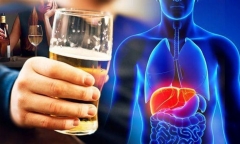 Dấu hiệu gan tổn thương do uống nhiều rượu bia