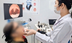 Ho dai dẳng, đi khám, cụ bà phát hiện thứ không ngờ mắc trong amidan